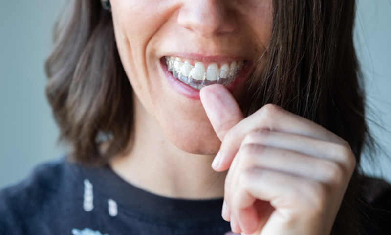A woman placing an Invisalign tray in her mouth