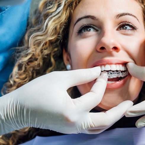A dentist placing an Invisalign tray over a woman’s teeth